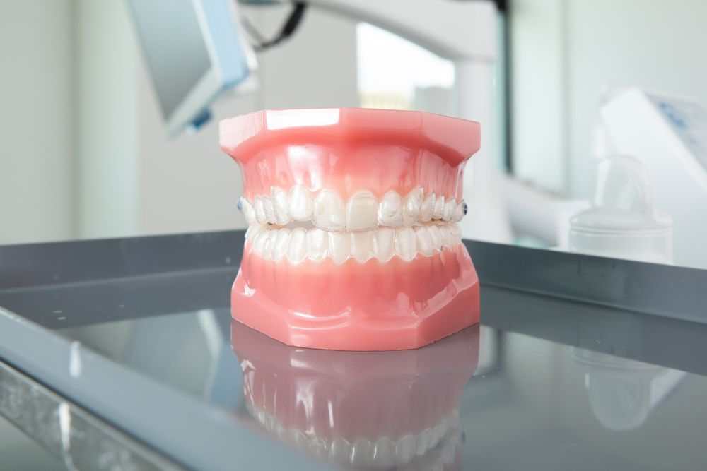 Braces Online V Braces In A Dental Clinic | Find Out The Differences