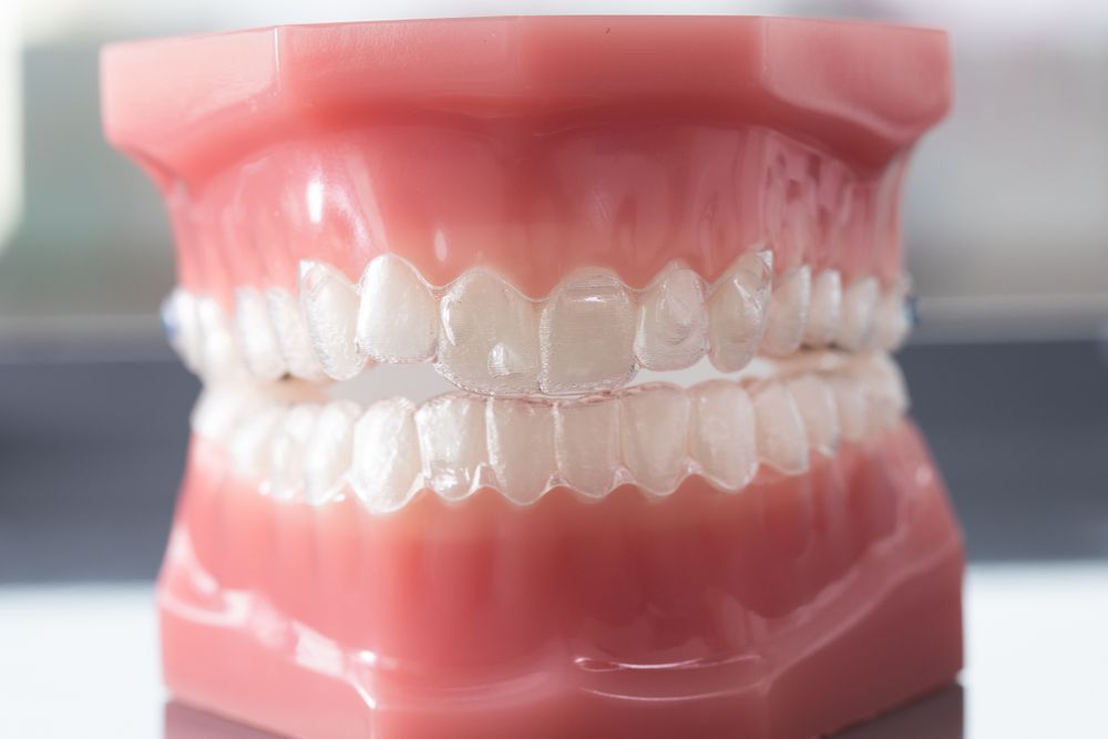 Invisalign Braces | Straight Teeth | Orthodontist // 3Dental